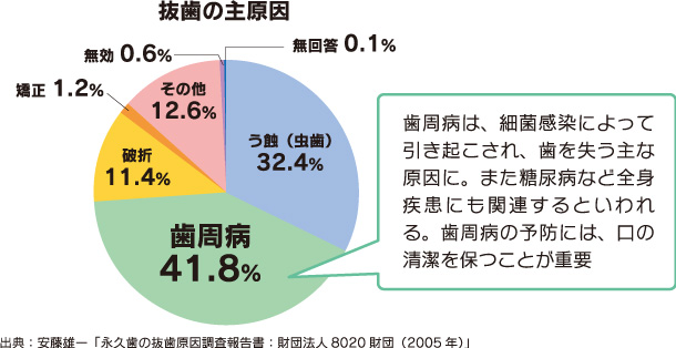 抜歯の主原因円グラフ画像