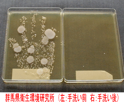 左：手洗い前、右：手洗い後の画像