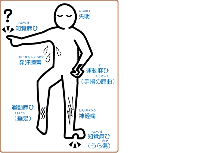 ハンセン病の症例を表した画像